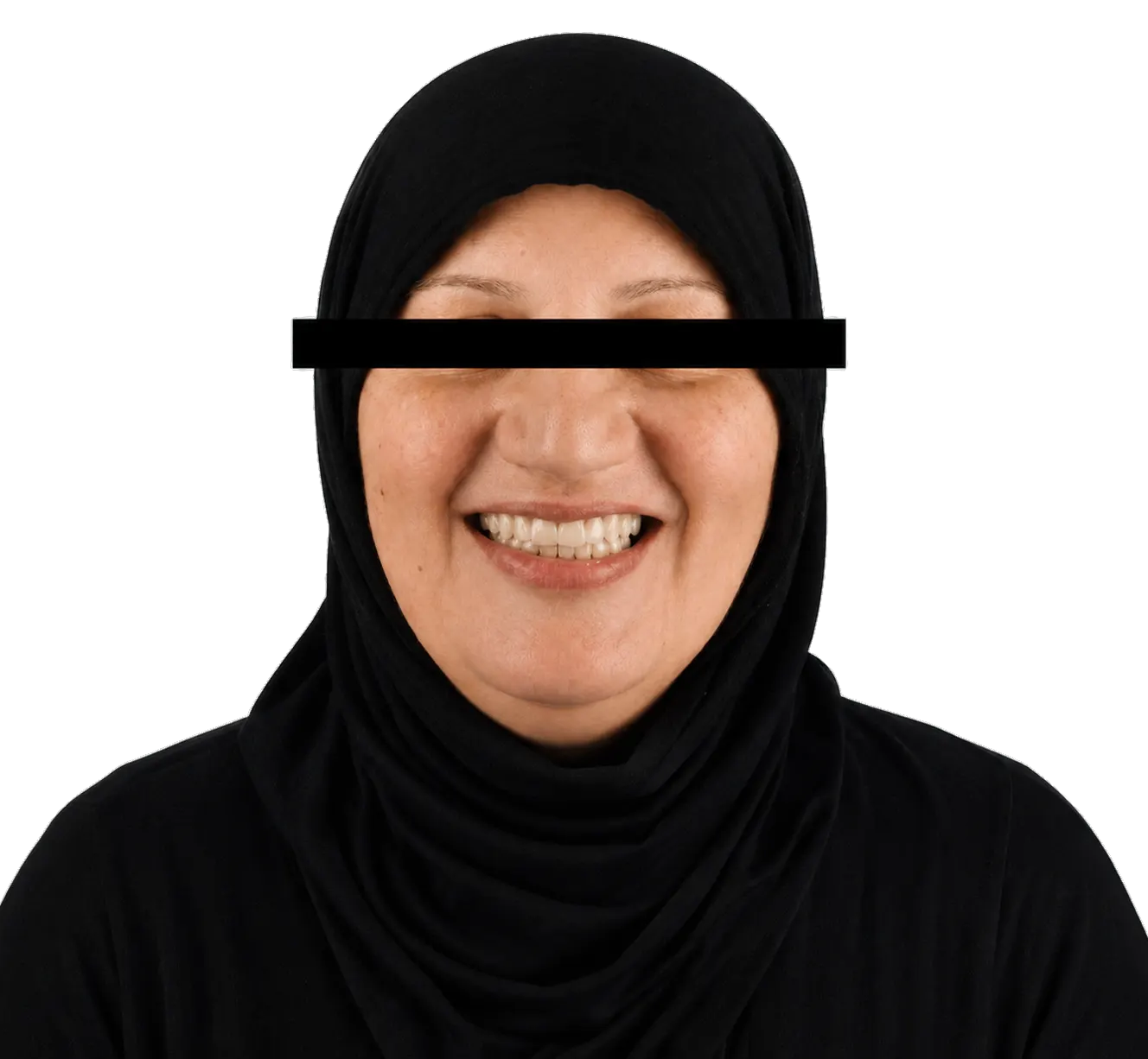Patiente souriante après la pose d'implants dentaires à la Zirconia Dental Clinic, Birkhadem, Alger